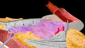 curso armonizacion facial anatomia jpg
