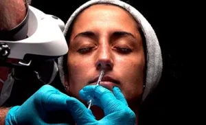 curso armonizacion facial tecnicas rinomodelacion jpg